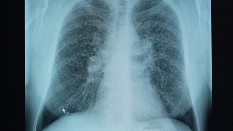 New rules to stop killer kitchen deaths - but do they go far enough?